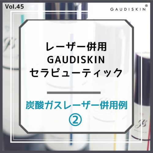 レーザー併用GAUDISKIN<br>セラピューティック<br>炭酸ガスレーザー併用例②